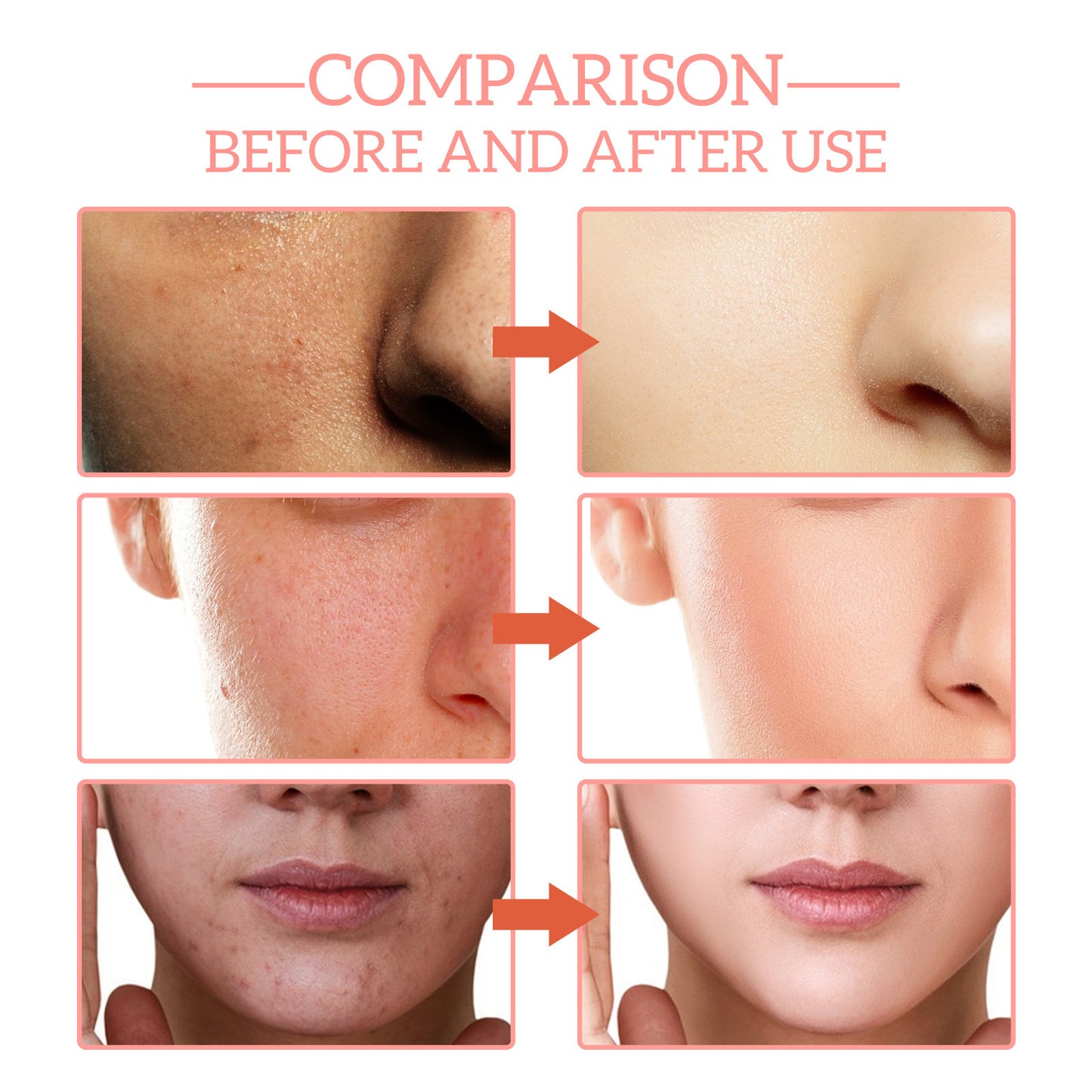 Hydrating 30ml Facial Essence – Anti-Aging, aufhellendes und feuchtigkeitsspendendes Serum