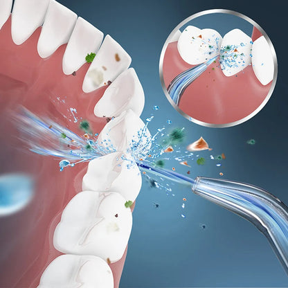 Portable High-Pressure Oral Irrigator – Manual Water Flosser for Deep Teeth Cleaning